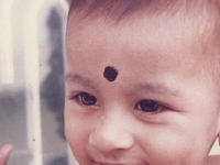 Childhood Childhood